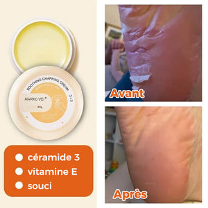 Crème anti-déchirure pour peau d'hiver